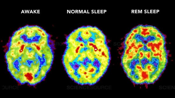 Il dormire: funzionamenti neurologici e coscienziali